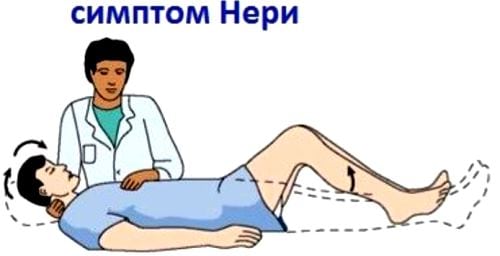 Поясничный остеохондроз с корешковым синдромом что это