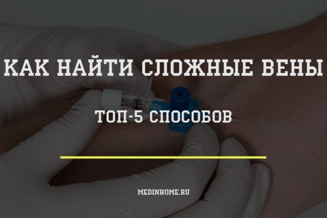 как найти сложне вены топ 5 способов